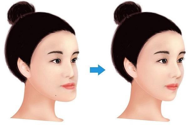 Bật mí số vận tướng người mặt gãy: Có chán như lời đồn? Bat mi so van tuong nguoi mat gay: Co chan nhu loi don?