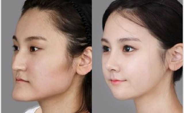 Bật mí số vận tướng người mặt gãy: Có chán như lời đồn? - Hình 2 Bat mi so van tuong nguoi mat gay: Co chan nhu loi don?-Hinh-2