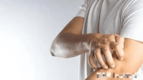 'Ngứa' 2 bộ phận trên cơ thể, đừng nhầm là dị ứng - Hình 2 'Ngua' 2 bo phan tren co the, dung nham la di ung-Hinh-2