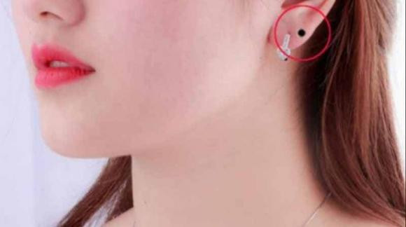 5 nốt ruồi đại hung, phá tài lộc của chủ nhân - Hình 2 5 not ruoi dai hung, pha tai loc cua chu nhan-Hinh-2