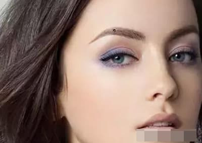 Những nốt ruồi may mắn không nên loại bỏ - Hình 3 Nhung not ruoi may man khong nen loai bo-Hinh-3