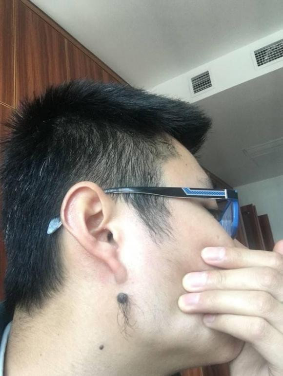 Nốt ruồi ở những bộ phận này đều là nốt ruồi may mắn, đừng tẩy - Hình 5 Not ruoi o nhung bo phan nay deu la not ruoi may man, dung tay-Hinh-5