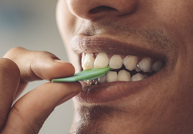 Điều gì xảy ra nếu chúng ta không đánh răng trong một năm? - Hình 3 Dieu gi xay ra neu chung ta khong danh rang trong mot nam?-Hinh-3