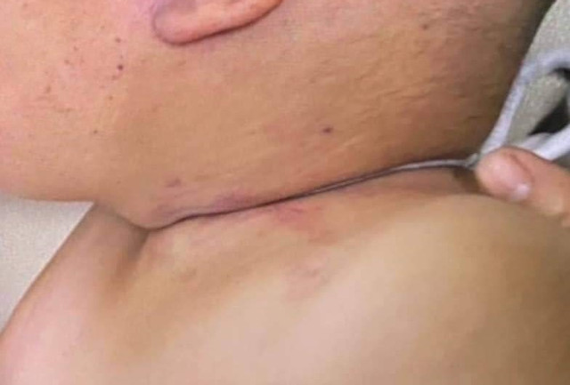 Thượng tá công an phân tích tâm lý kẻ nhốt bé trai vào tủ cấp đông - Hình 2 Thuong ta cong an phan tich tam ly ke nhot be trai vao tu cap dong-Hinh-2