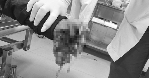 Hai học sinh thương vong sau tiếng nổ lớn trong đêm Hai hoc sinh thuong vong sau tieng no lon trong dem
