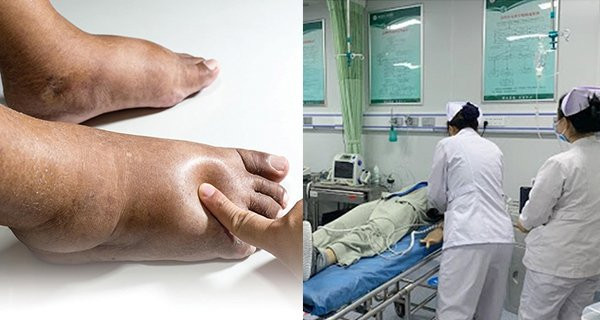 Người có thận tốt thường có 5 đặc điểm khi thức dậy vào buổi sáng Nguoi co than tot thuong co 5 dac diem khi thuc day vao buoi sang