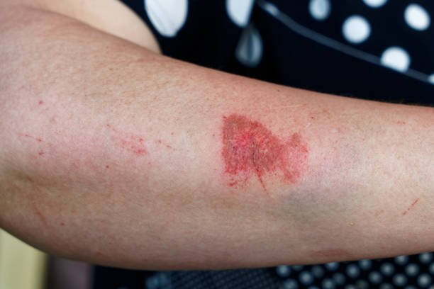 6 dấu hiệu chứng tỏ sức đề kháng yếu, dễ bị virus tấn công - Hình 2 6 dau hieu chung to suc de khang yeu, de bi virus tan cong-Hinh-2