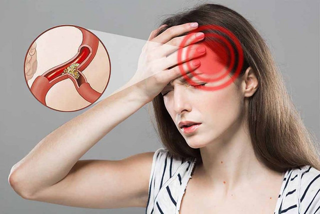 Bị thiếu máu não đừng chủ quan vì có thể gây đột quỵ Bi thieu mau nao dung chu quan vi co the gay dot quy