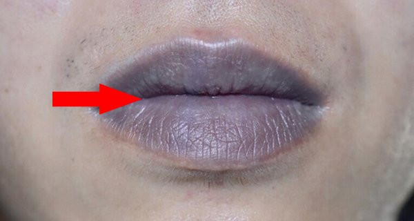 3 biểu hiện trên khuôn mặt cho thấy bạn có thể đang mắc bệnh gan 3 bieu hien tren khuon mat cho thay ban co the dang mac benh gan