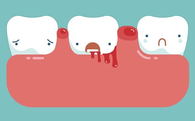 3 biểu hiện trên khuôn mặt cho thấy bạn có thể đang mắc bệnh gan - Hình 3 3 bieu hien tren khuon mat cho thay ban co the dang mac benh gan-Hinh-3