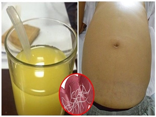 Cách tẩy giun cho con bằng rau củ quả vừa an toàn vừa hiệu quả Cach tay giun cho con bang rau cu qua vua an toan vua hieu qua