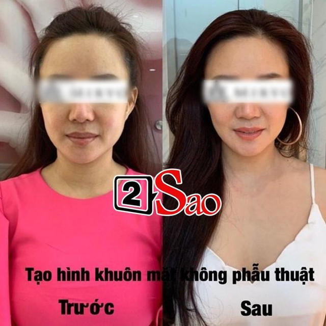 Khuyết điểm của Vy Oanh "dao kéo" cũng quỳ lạy tránh xa - Hình 4 Khuyet diem cua Vy Oanh
