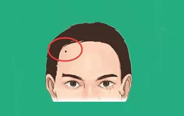 4 nốt ruồi tụ tài trên mặt, ai sở hữu là may mắn tột đỉnh - Hình 2 4 not ruoi tu tai tren mat, ai so huu la may man tot dinh-Hinh-2