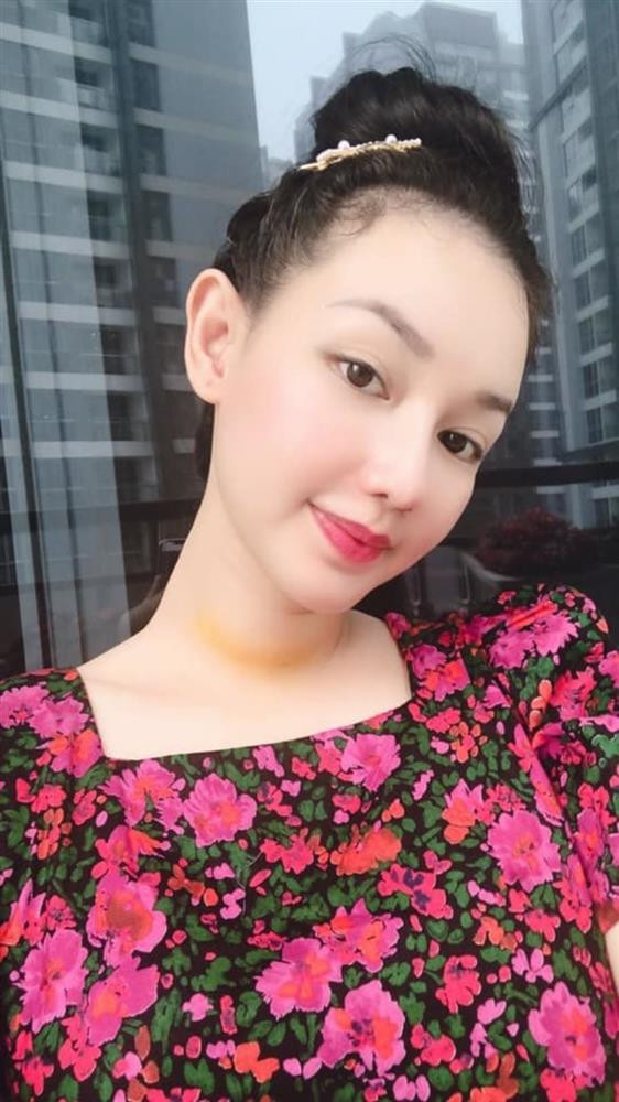 MC Quỳnh Chi khoe "phụ kiện sẹo" sau phẫu thuật ung thư tuyến giáp - Hình 2 MC Quynh Chi khoe