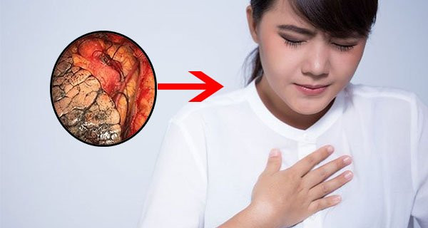 Cơ thể xuất hiện "3 nhanh 2 nhỏ" cảnh báo tuổi thọ đang bị rút ngắn Co the xuat hien