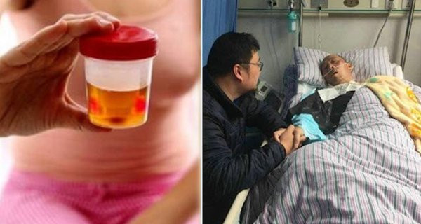 Sáng ngủ dậy thử cách này biết ngay mình mắc bệnh thận hay không Sang ngu day thu cach nay biet ngay minh mac benh than hay khong
