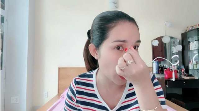 Cát Tường kể hành trình sửa mũi 5 lần và biến chứng đáng sợ - Hình 4 Cat Tuong ke hanh trinh sua mui 5 lan va bien chung dang so-Hinh-4