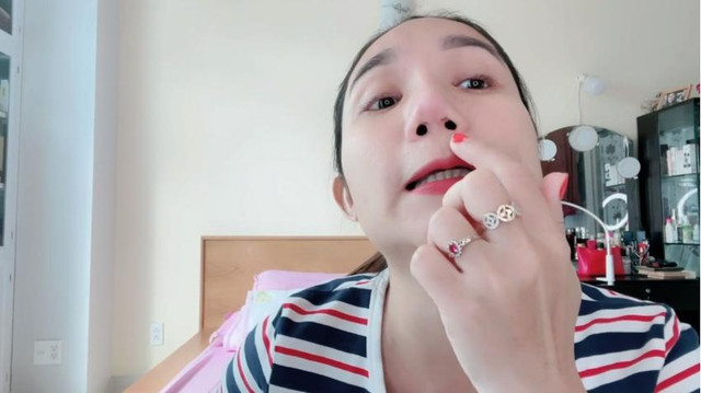 Cát Tường kể hành trình sửa mũi 5 lần và biến chứng đáng sợ - Hình 7 Cat Tuong ke hanh trinh sua mui 5 lan va bien chung dang so-Hinh-7