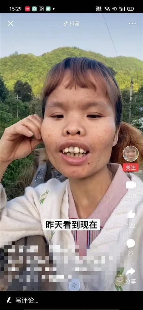 Người phụ nữ xấu nhất Tiktok giàu kếch xù, nhìn chồng mới kinh ngạc - Hình 2 Nguoi phu nu xau nhat Tiktok giau kech xu, nhin chong moi kinh ngac-Hinh-2