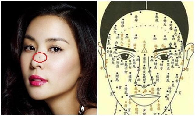 3 nốt ruồi trên mặt vừa hiếm vừa “quý như vàng” - Hình 2 3 not ruoi tren mat vua hiem vua “quy nhu vang”-Hinh-2