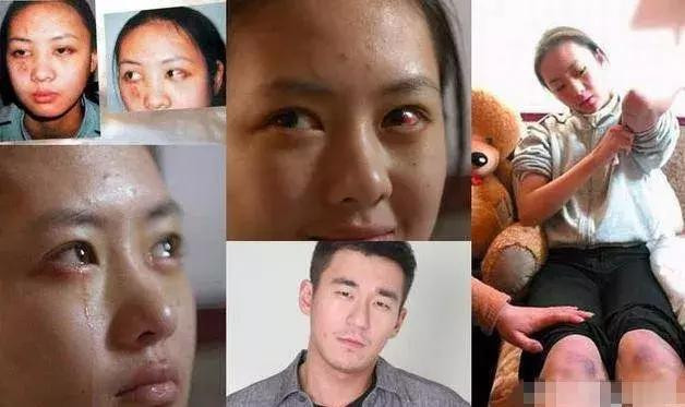 Những mỹ nhân Hoa ngữ bị người tình đánh đập hung tàn - Hình 7 Nhung my nhan Hoa ngu bi nguoi tinh danh dap hung tan-Hinh-7