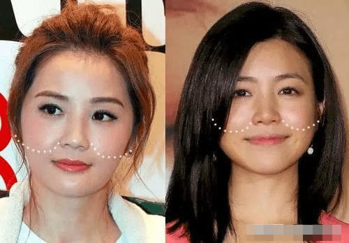 Những người có rãnh mũi má dài tốt hay xấu? - Hình 3 Nhung nguoi co ranh mui ma dai tot hay xau?-Hinh-3