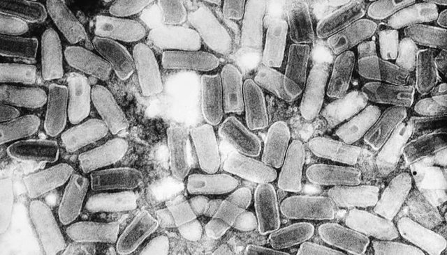 Các loại virus ngoài đời thực có thể tạo ra 'zombie' hay không? - Hình 2 Cac loai virus ngoai doi thuc co the tao ra 'zombie' hay khong?-Hinh-2