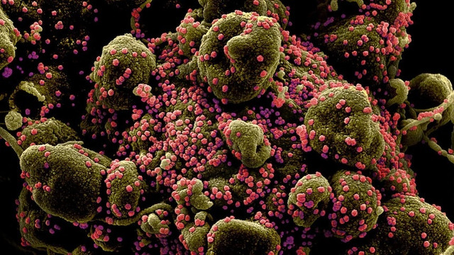 Phát hiện virus mới giống SARS-CoV-2 ở Trung Quốc - Hình 2 Phat hien virus moi giong SARS-CoV-2 o Trung Quoc-Hinh-2