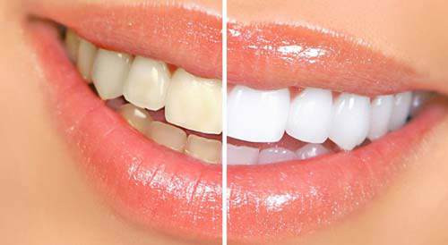 Tất tần tật công dụng làm đẹp của dầu dừa và tác hại nếu dùng sai - Hình 3 Tat tan tat cong dung lam dep cua dau dua va tac hai neu dung sai-Hinh-3