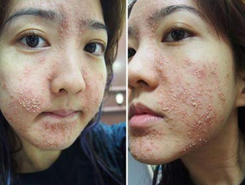 Tất tần tật công dụng làm đẹp của dầu dừa và tác hại nếu dùng sai - Hình 12 Tat tan tat cong dung lam dep cua dau dua va tac hai neu dung sai-Hinh-12