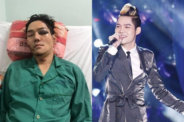 Con nuôi Hoài Linh ra sao sau tai nạn chấn thương sọ não? Con nuoi Hoai Linh ra sao sau tai nan chan thuong so nao?