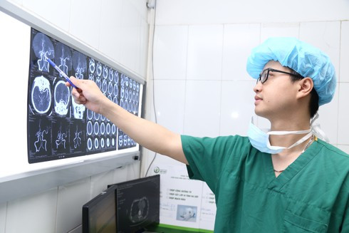 Những dấu hiệu nhận biết cơn đột quỵ sắp đến Nhung dau hieu nhan biet con dot quy sap den
