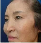Người có 4 nét mặt này tính cách và tính tình đặc biệt xấu - Hình 4 Nguoi co 4 net mat nay tinh cach va tinh tinh dac biet xau-Hinh-4