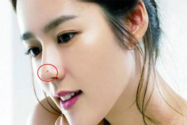 4 nốt ruồi tài lộc, cơ hội trở thành tỷ phú kếch sù sau 1 đêm - Hình 2 4 not ruoi tai loc, co hoi tro thanh ty phu kech su sau 1 dem-Hinh-2