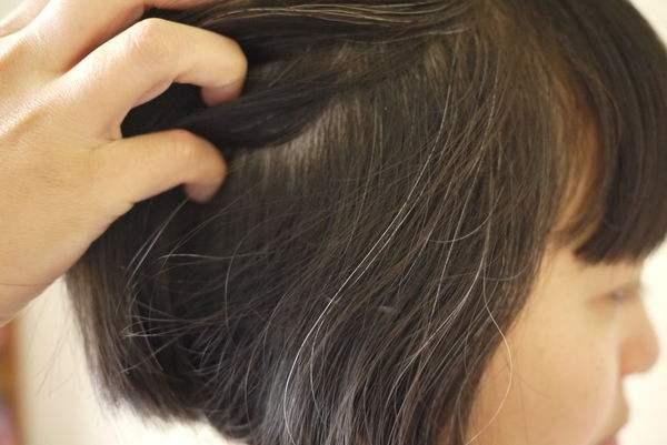 Tóc bạc xuất hiện ở đây có thể là dấu hiệu chức năng gan suy giảm Toc bac xuat hien o day co the la dau hieu chuc nang gan suy giam