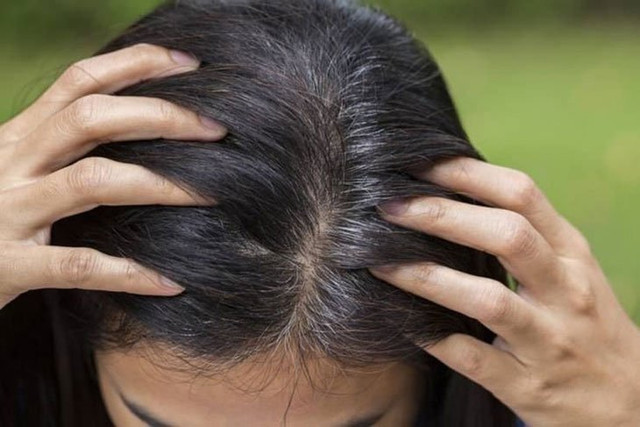 Tóc bạc xuất hiện ở đây có thể là dấu hiệu chức năng gan suy giảm - Hình 2 Toc bac xuat hien o day co the la dau hieu chuc nang gan suy giam-Hinh-2