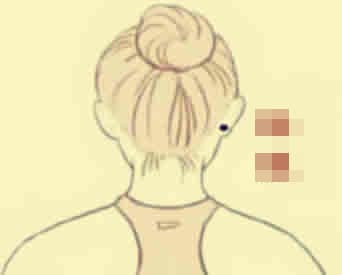 Bảy nốt ruồi giúp bạn giàu sang, sớm muộn gì cũng phất phát lắm tiền! - Hình 4 Bay not ruoi giup ban giau sang, som muon gi cung phat phat lam tien!-Hinh-4