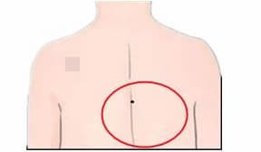 Bảy nốt ruồi giúp bạn giàu sang, sớm muộn gì cũng phất phát lắm tiền! - Hình 5 Bay not ruoi giup ban giau sang, som muon gi cung phat phat lam tien!-Hinh-5