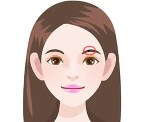 Bảy nốt ruồi giúp bạn giàu sang, sớm muộn gì cũng phất phát lắm tiền! - Hình 3 Bay not ruoi giup ban giau sang, som muon gi cung phat phat lam tien!-Hinh-3
