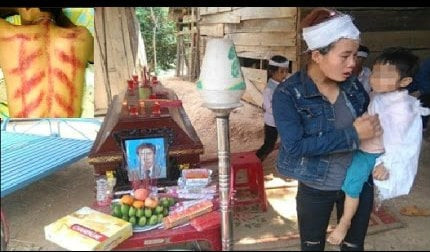 Chồng tôi đột ngột hôn mê sâu rồi qua đời sau khi cạo gió Chong toi dot ngot hon me sau roi qua doi sau khi cao gio
