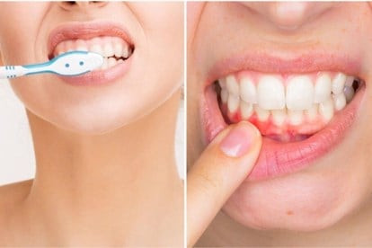 Bộ phận trên cơ thể được vệ sinh hàng ngày mà lạ thay vẫn “hôi” - Hình 2 Bo phan tren co the duoc ve sinh hang ngay ma la thay van “hoi”-Hinh-2