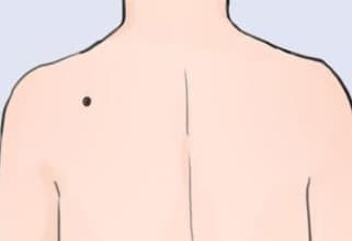 Những người phụ nữ có nốt ruồi ở những vị trí này cả đời phú quý - Hình 5 Nhung nguoi phu nu co not ruoi o nhung vi tri nay ca doi phu quy-Hinh-5