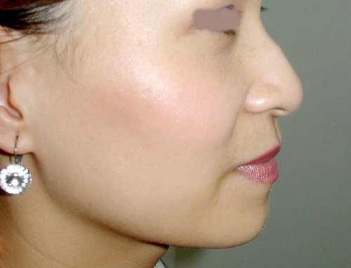 5 nét tướng của người phụ nữ bạc phận, cả đời lận đận - Hình 3 5 net tuong cua nguoi phu nu bac phan, ca doi lan dan-Hinh-3