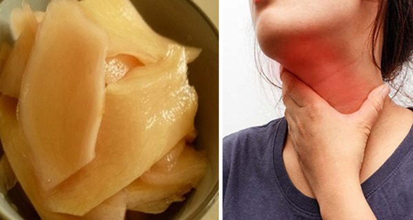 Món ăn chữa dứt chứng trào ngược dạ dày, ngăn ngừa K thực quản Mon an chua dut chung trao nguoc da day, ngan ngua K thuc quan