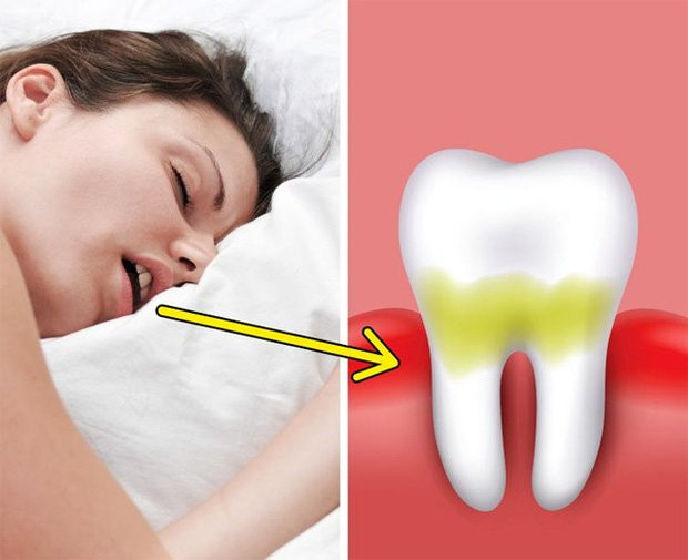 Người có gan xấu thường có 4 biểu hiện trên môi - Hình 2 Nguoi co gan xau thuong co 4 bieu hien tren moi-Hinh-2