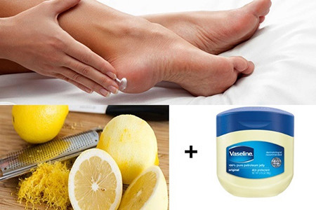 Cách trị nứt nẻ gót chân bằng loạt công thức đơn giản Cach tri nut ne got chan bang loat cong thuc don gian