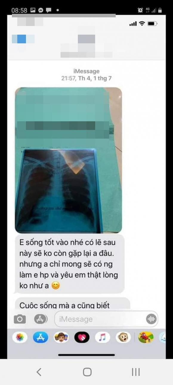 Chàng trai bịa chuyện có khối u trong người để cắt đuôi người yêu - Hình 6 Chang trai bia chuyen co khoi u trong nguoi de cat duoi nguoi yeu-Hinh-6