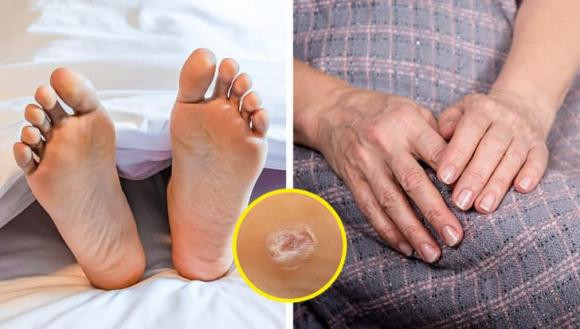 Nốt ruồi đến từ đâu, tại sao việc phân biệt chúng lại quan trọng? - Hình 5 Not ruoi den tu dau, tai sao viec phan biet chung lai quan trong?-Hinh-5