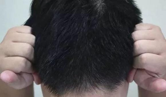 Trên tai có "công tắc nhỏ" để bổ thận tráng dương, nên thường xuyên "véo" - Hình 3 Tren tai co