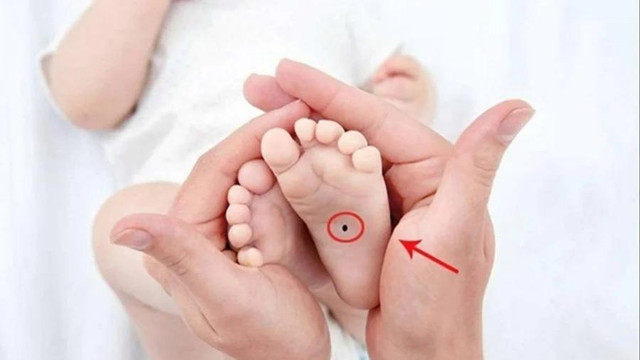 Trẻ có nốt ruồi 3 vị trí này tương lai sáng, phú quý hơn người Tre co not ruoi 3 vi tri nay tuong lai sang, phu quy hon nguoi